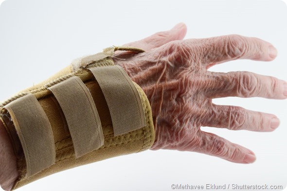 Rheumatoid arthritis hand brace
